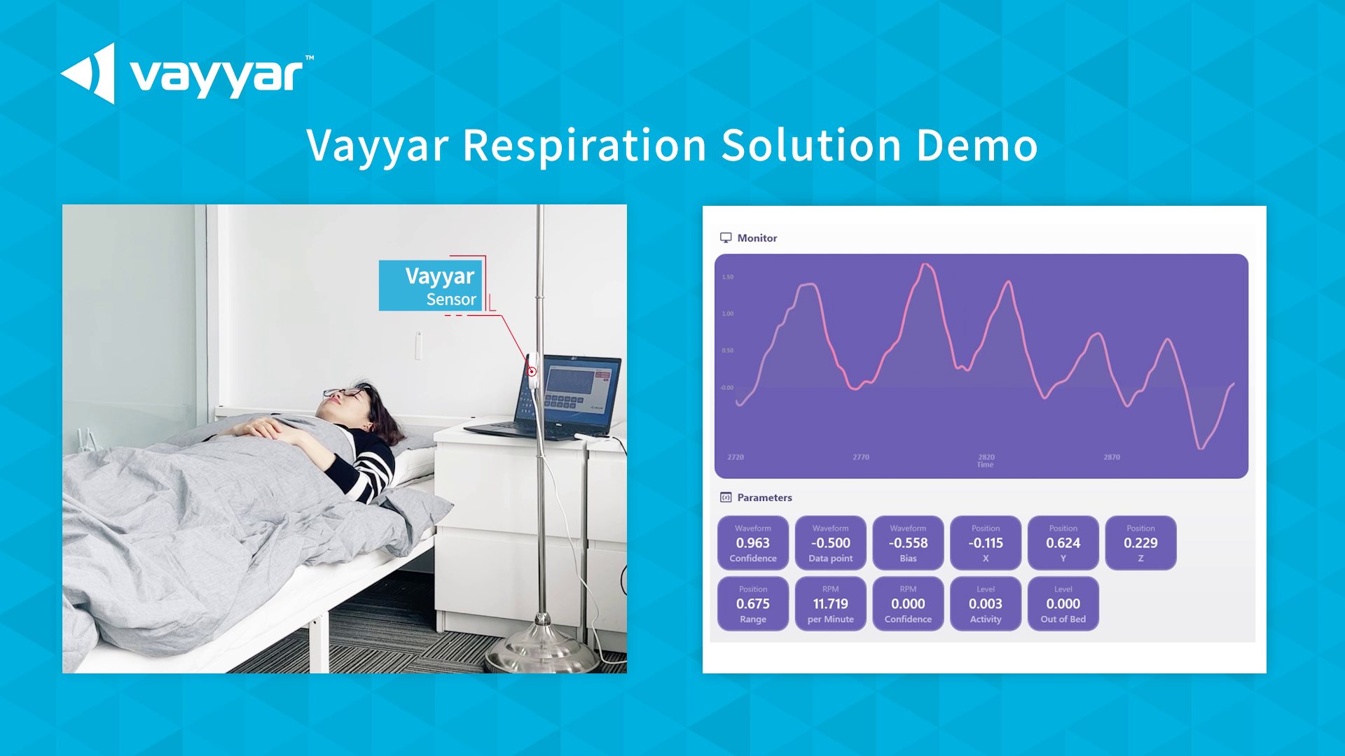 Respiration Monitoring